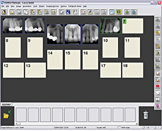 screenshot of Gendex VixWin Platinum